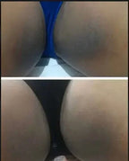 🔥CLAREIA MANCHAS ESCURAS NO CORPO: ROSTO, AXILAS, BUNDAS, VIRILHAS E UNIFORMIZE SUA PELE EM 14 DIAS😍
