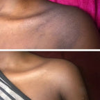 🔥CLAREIA MANCHAS ESCURAS NO CORPO: ROSTO, AXILAS, BUNDAS, VIRILHAS E UNIFORMIZE SUA PELE EM 14 DIAS😍