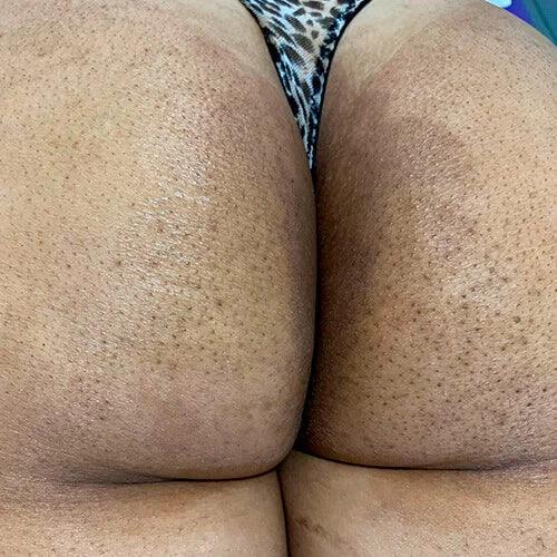 🔥CLAREIA MANCHAS ESCURAS NO CORPO: ROSTO, AXILAS, BUNDAS, VIRILHAS E UNIFORMIZE SUA PELE EM 14 DIAS😍